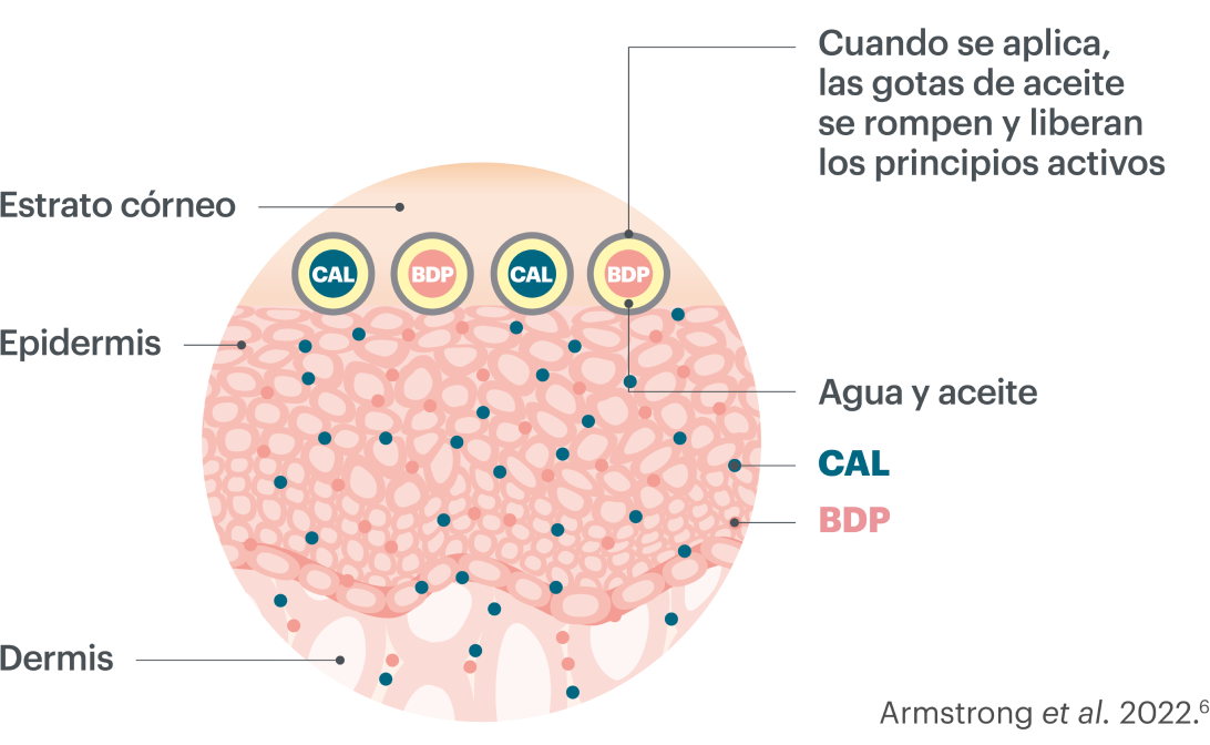 capas piel wynzora